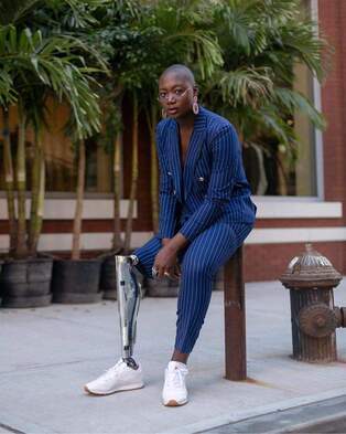 Beautiful young black business woman with prosthetic leg seated outdoors